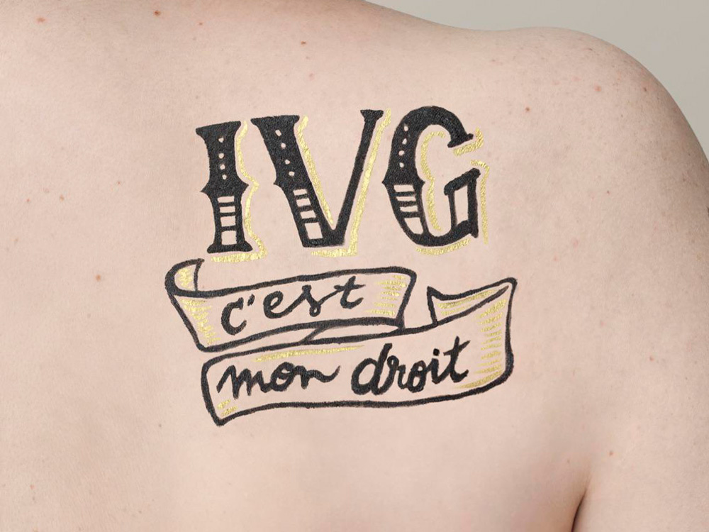 IVG - C'est mon droit